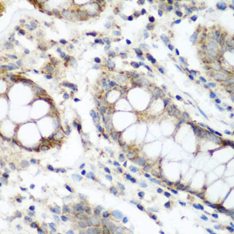 Immunohistochemistry - Anti-FLJ14154 Antibody (A15676) - Antibodies.com