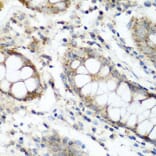 Immunohistochemistry - Anti-FLJ14154 Antibody (A15676) - Antibodies.com