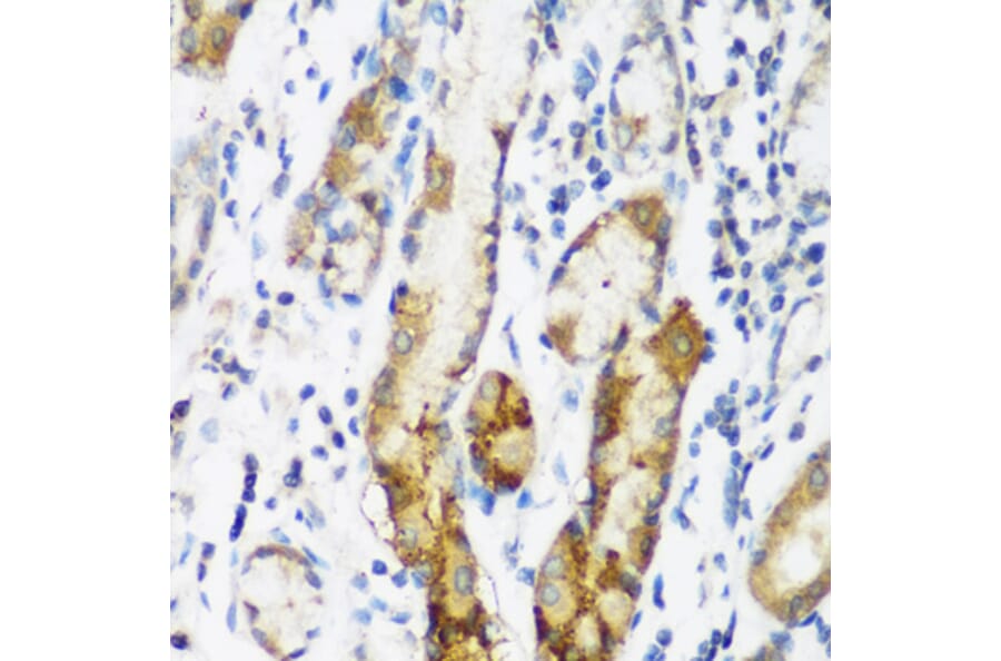 Immunohistochemistry - Anti-FLJ14154 Antibody (A15676) - Antibodies.com