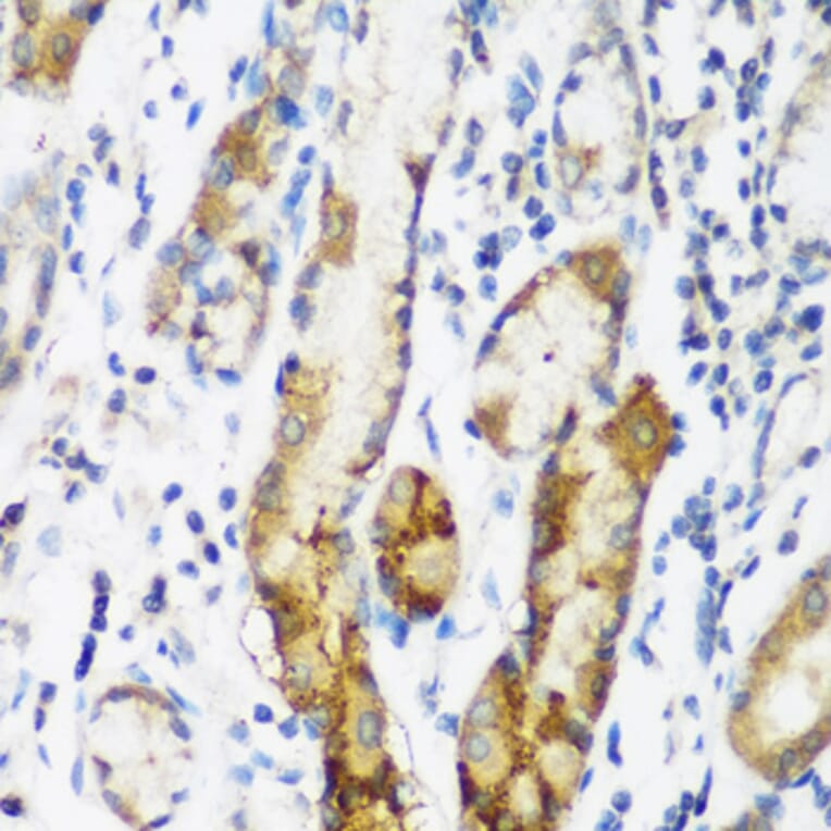Immunohistochemistry - Anti-FLJ14154 Antibody (A15676) - Antibodies.com
