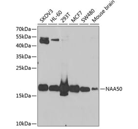 Western Blot - Anti-NAT13 Antibody (A15677) - Antibodies.com