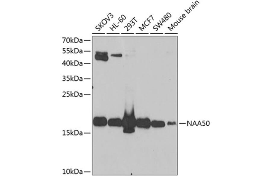 Western Blot - Anti-NAT13 Antibody (A15677) - Antibodies.com