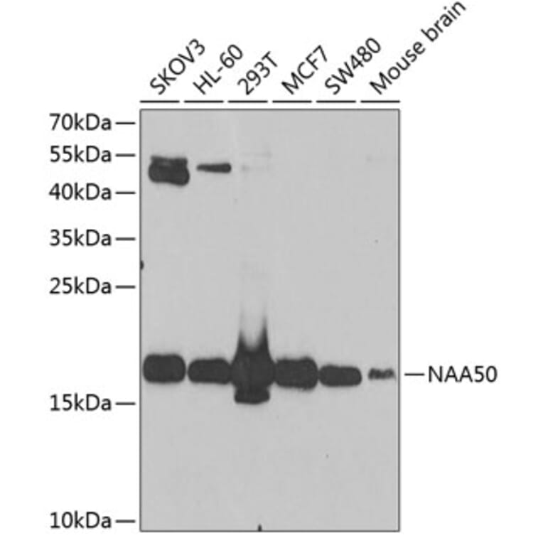 Western Blot - Anti-NAT13 Antibody (A15677) - Antibodies.com