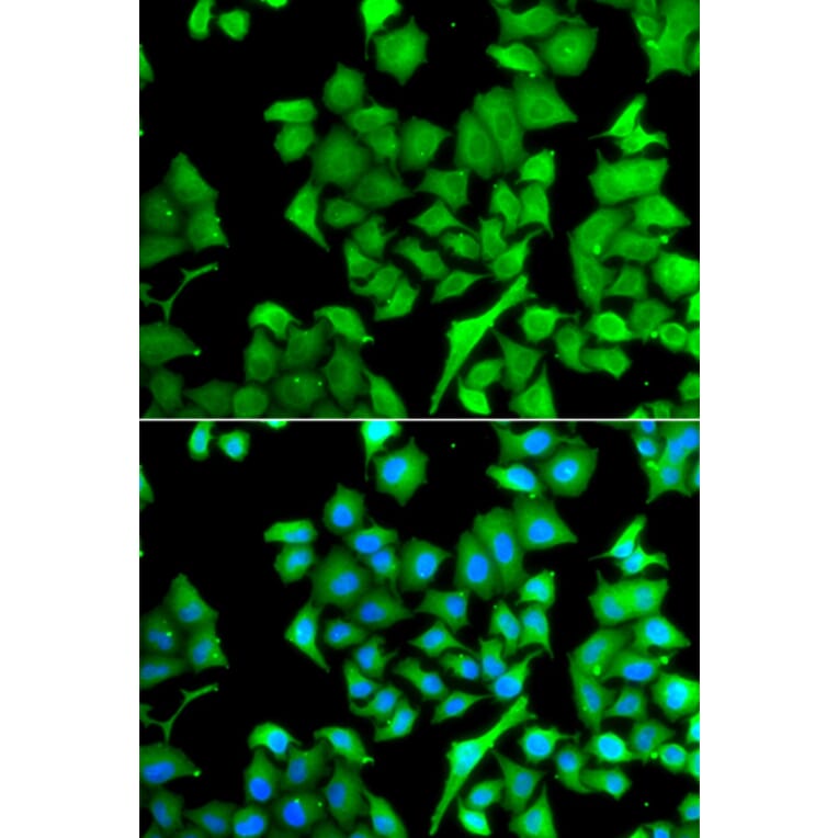 Immunofluorescence - Anti-NAT13 Antibody (A15677) - Antibodies.com