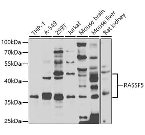 Western Blot - Anti-RASSF5 Antibody (A7389) - Antibodies.com