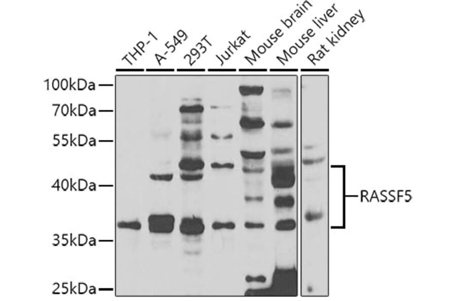 Western Blot - Anti-RASSF5 Antibody (A7389) - Antibodies.com