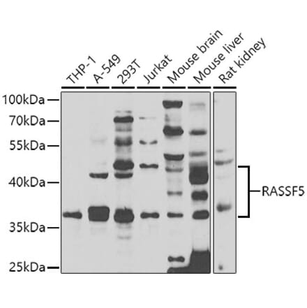 Western Blot - Anti-RASSF5 Antibody (A7389) - Antibodies.com