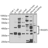 Western Blot - Anti-RASSF5 Antibody (A7389) - Antibodies.com