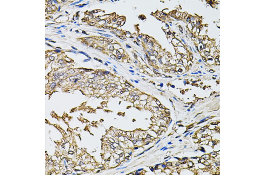 Immunohistochemistry - Anti-RASSF5 Antibody (A7389) - Antibodies.com
