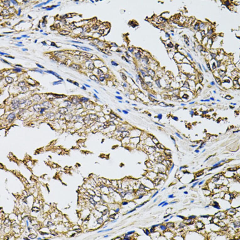 Immunohistochemistry - Anti-RASSF5 Antibody (A7389) - Antibodies.com