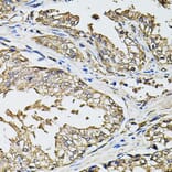 Immunohistochemistry - Anti-RASSF5 Antibody (A7389) - Antibodies.com