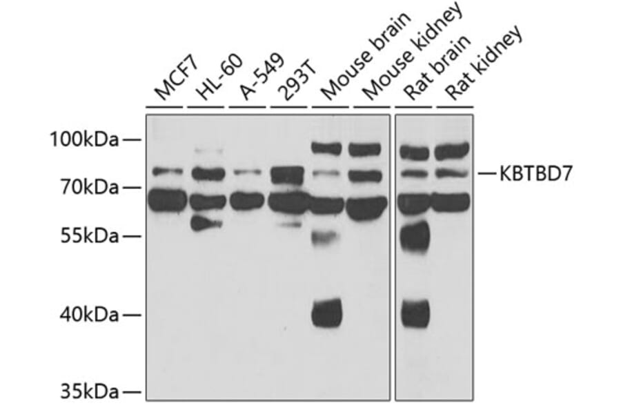Western Blot - Anti-KBTBD7 Antibody (A15679) - Antibodies.com