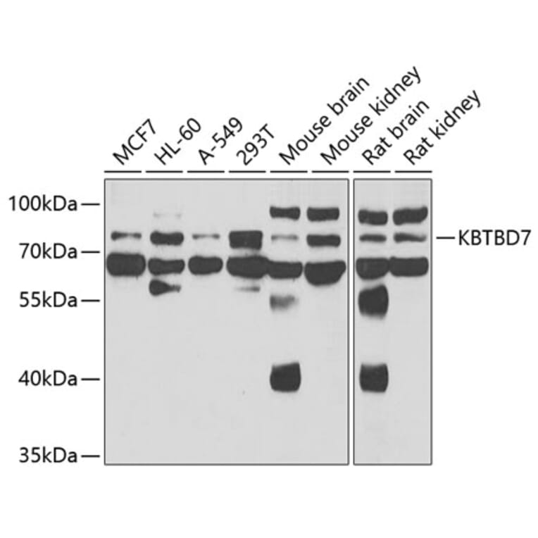 Western Blot - Anti-KBTBD7 Antibody (A15679) - Antibodies.com