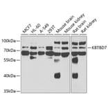 Western Blot - Anti-KBTBD7 Antibody (A15679) - Antibodies.com
