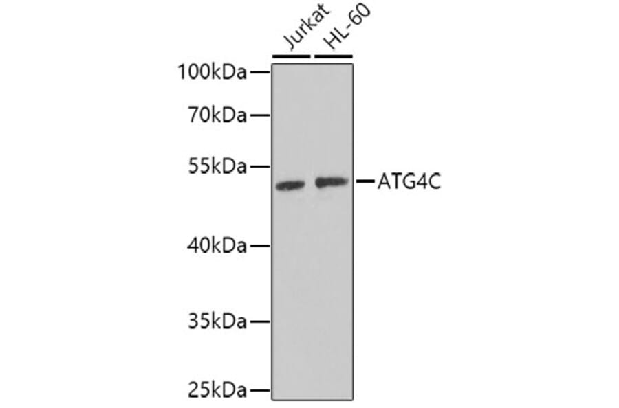 Western Blot - Anti-ATG4C Antibody (A15680) - Antibodies.com
