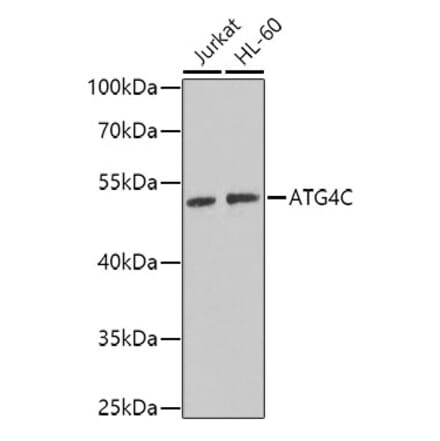 Western Blot - Anti-ATG4C Antibody (A15680) - Antibodies.com