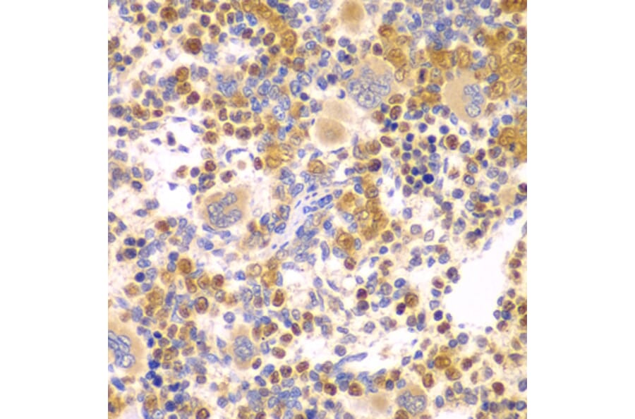Immunohistochemistry - Anti-DTX2 Antibody (A15681) - Antibodies.com