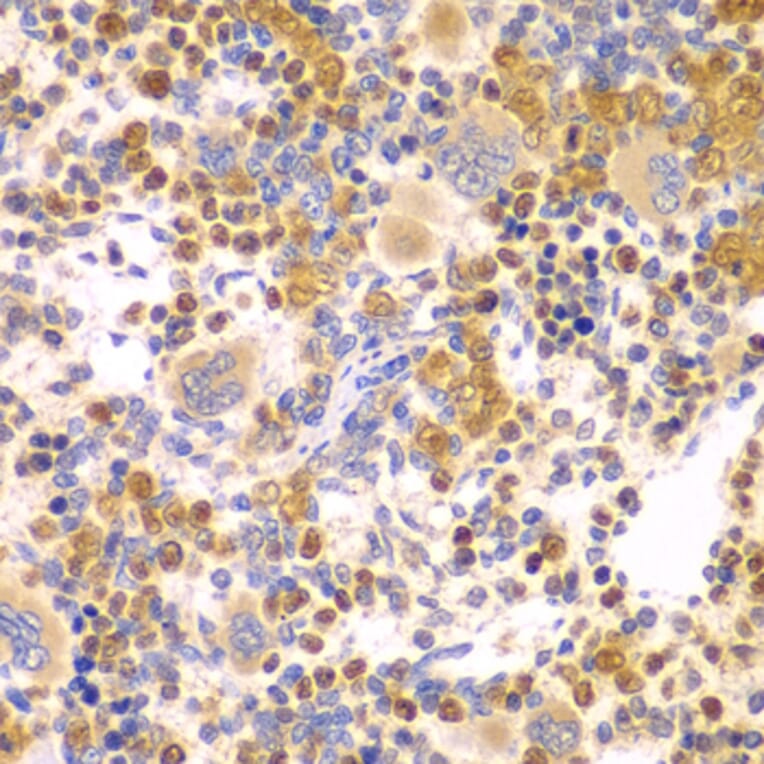 Immunohistochemistry - Anti-DTX2 Antibody (A15681) - Antibodies.com