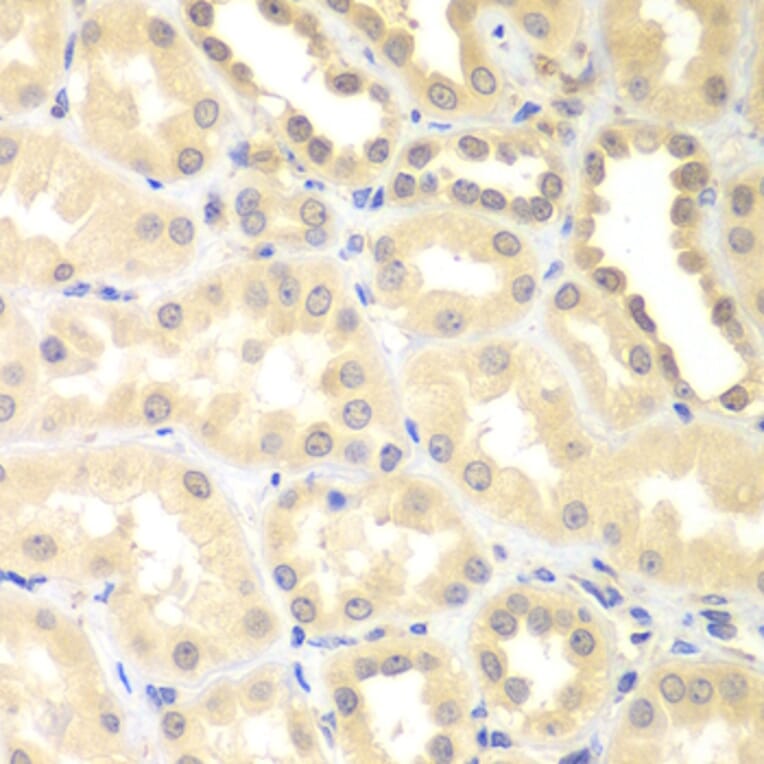 Immunohistochemistry - Anti-DTX2 Antibody (A15681) - Antibodies.com