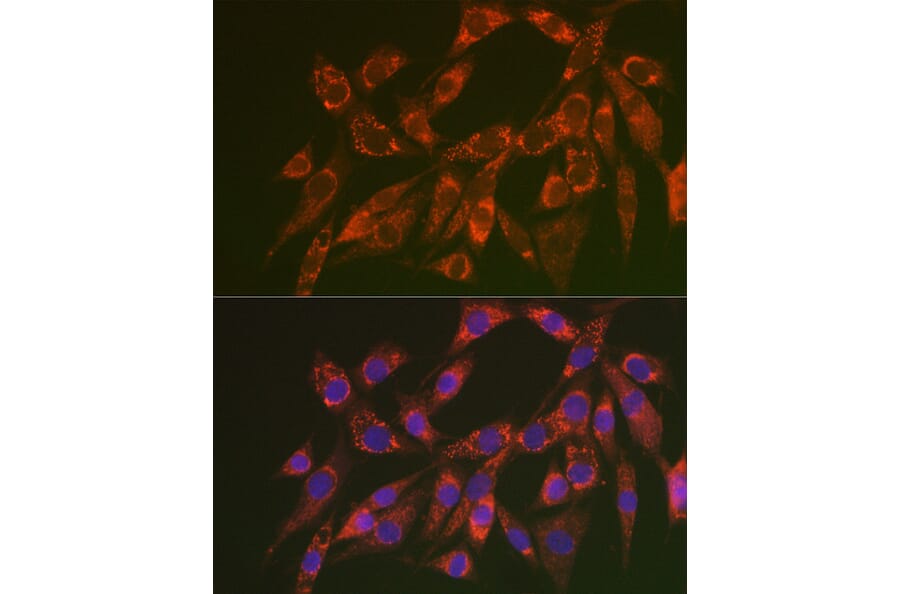 Immunofluorescence - Anti-CHMP4B Antibody (A15682) - Antibodies.com