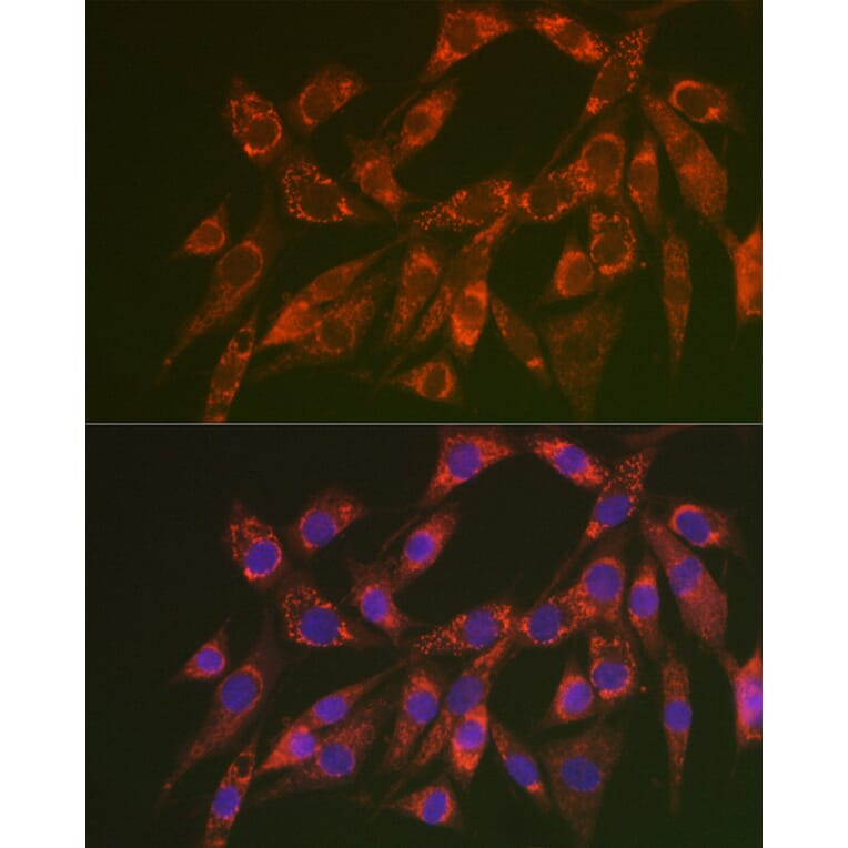 Immunofluorescence - Anti-CHMP4B Antibody (A15682) - Antibodies.com