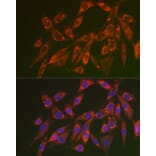 Immunofluorescence - Anti-CHMP4B Antibody (A15682) - Antibodies.com