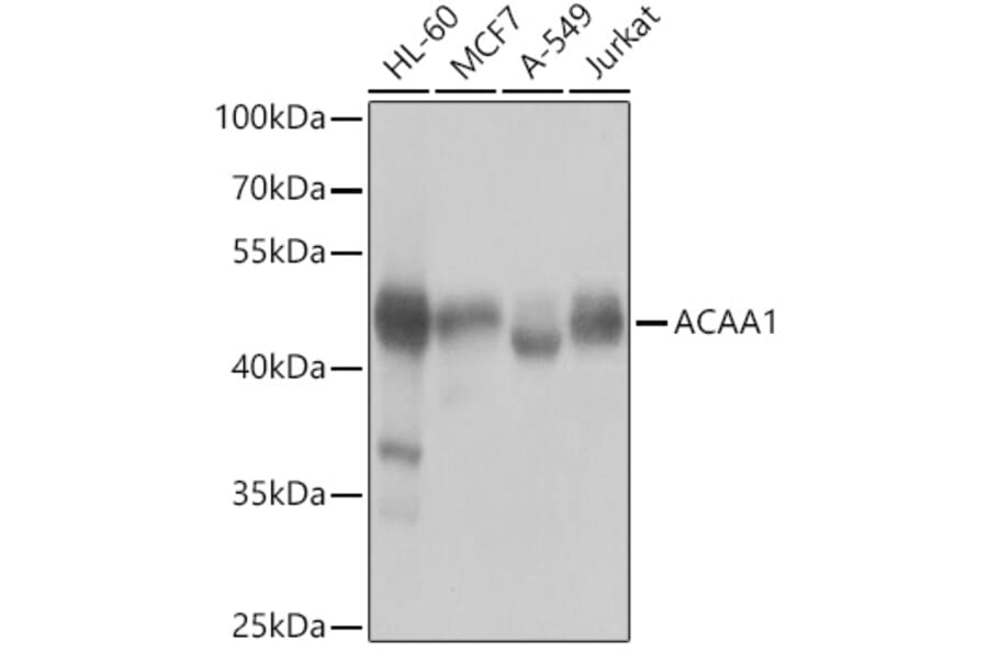 Western Blot - Anti-ACAA1/Beta-ketothiolase Antibody (A15684) - Antibodies.com