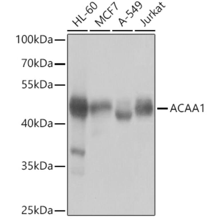 Western Blot - Anti-ACAA1/Beta-ketothiolase Antibody (A15684) - Antibodies.com