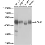 Western Blot - Anti-ACAA1/Beta-ketothiolase Antibody (A15684) - Antibodies.com