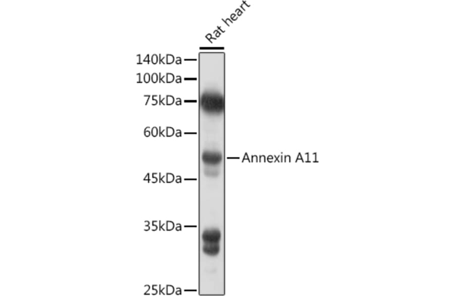 Western Blot - Anti-Annexin-11/ANXA11 Antibody (A15685) - Antibodies.com