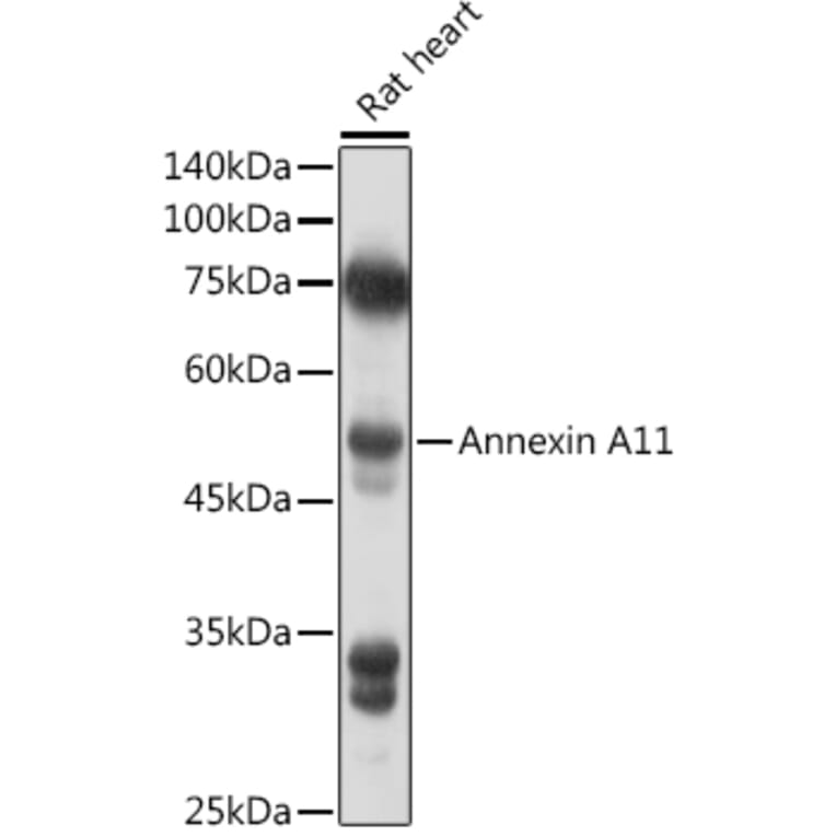 Western Blot - Anti-Annexin-11/ANXA11 Antibody (A15685) - Antibodies.com