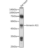 Western Blot - Anti-Annexin-11/ANXA11 Antibody (A15685) - Antibodies.com