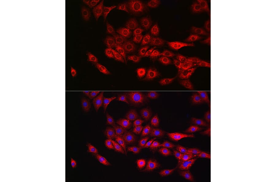 Immunofluorescence - Anti-Annexin-11/ANXA11 Antibody (A15685) - Antibodies.com