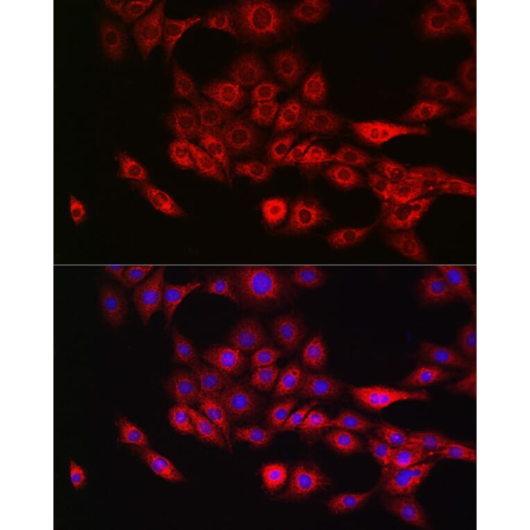 Immunofluorescence - Anti-Annexin-11/ANXA11 Antibody (A15685) - Antibodies.com