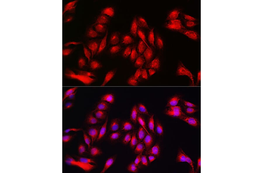 Immunofluorescence - Anti-Annexin-11/ANXA11 Antibody (A15685) - Antibodies.com