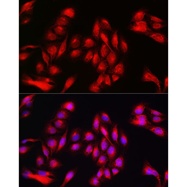Immunofluorescence - Anti-Annexin-11/ANXA11 Antibody (A15685) - Antibodies.com