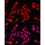 Immunofluorescence - Anti-Annexin-11/ANXA11 Antibody (A15685) - Antibodies.com