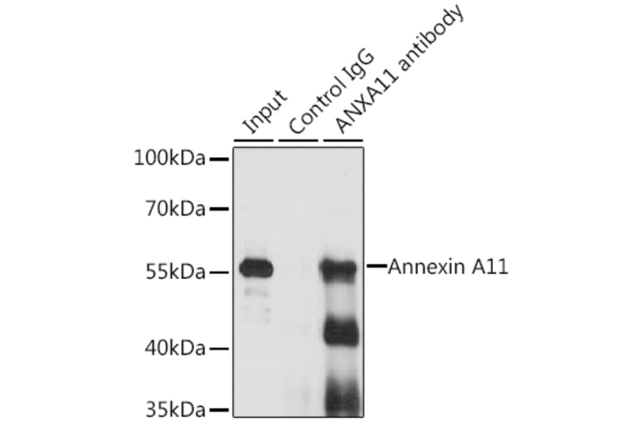 Western Blot - Anti-Annexin-11/ANXA11 Antibody (A15685) - Antibodies.com