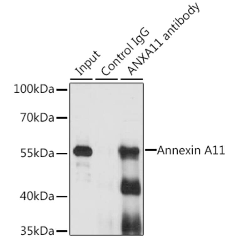 Western Blot - Anti-Annexin-11/ANXA11 Antibody (A15685) - Antibodies.com