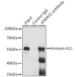 Western Blot - Anti-Annexin-11/ANXA11 Antibody (A15685) - Antibodies.com