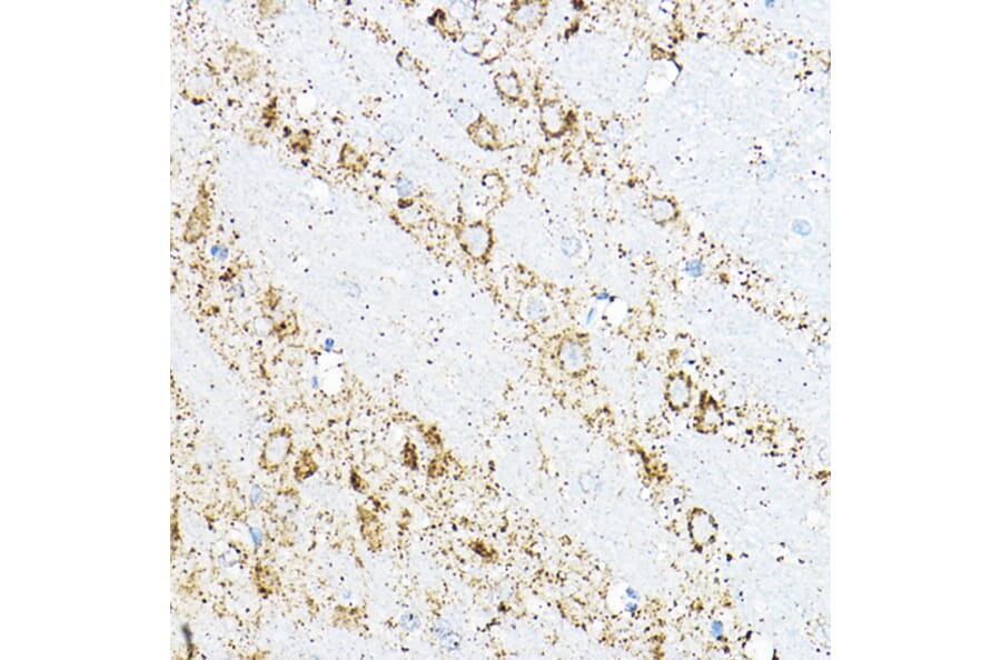 Immunohistochemistry - Anti-BCAT2 Antibody (A15687) - Antibodies.com