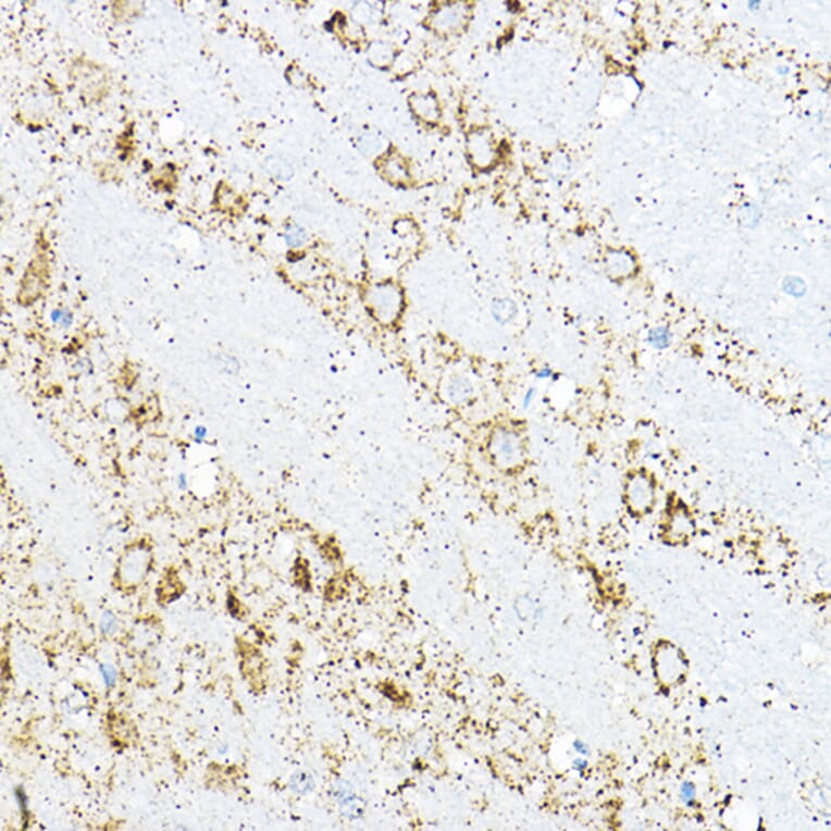 Immunohistochemistry - Anti-BCAT2 Antibody (A15687) - Antibodies.com