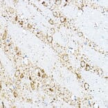 Immunohistochemistry - Anti-BCAT2 Antibody (A15687) - Antibodies.com