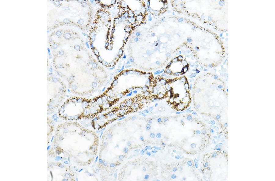 Immunohistochemistry - Anti-BCAT2 Antibody (A15687) - Antibodies.com