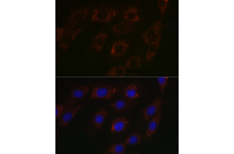 Immunofluorescence - Anti-BCAT2 Antibody (A15687) - Antibodies.com