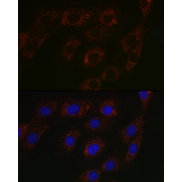 Immunofluorescence - Anti-BCAT2 Antibody (A15687) - Antibodies.com