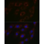 Immunofluorescence - Anti-BCAT2 Antibody (A15687) - Antibodies.com