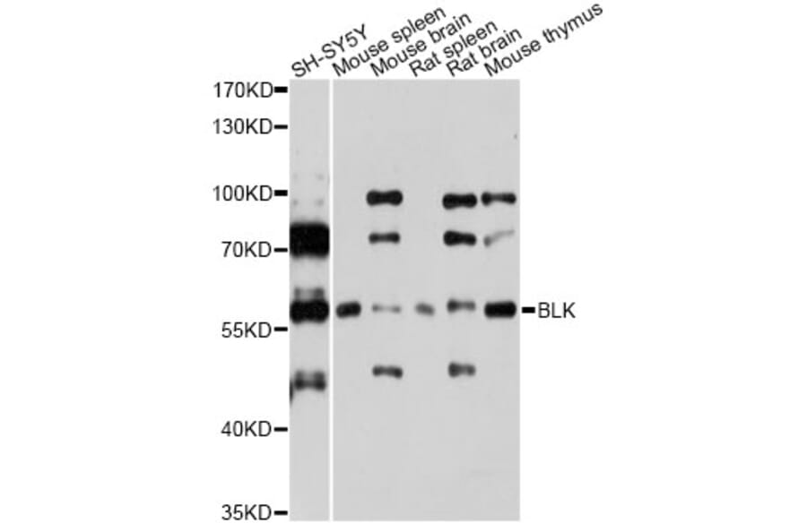 Western Blot - Anti-BLK Antibody (A7427) - Antibodies.com
