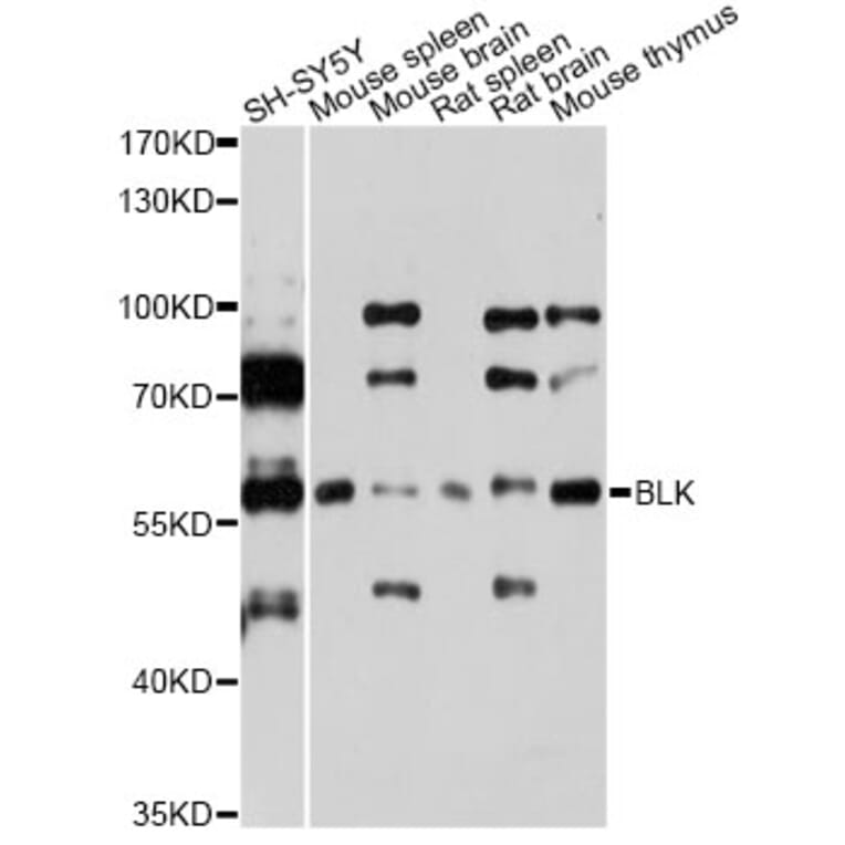 Western Blot - Anti-BLK Antibody (A7427) - Antibodies.com