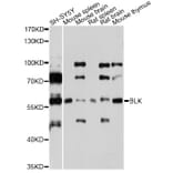 Western Blot - Anti-BLK Antibody (A7427) - Antibodies.com